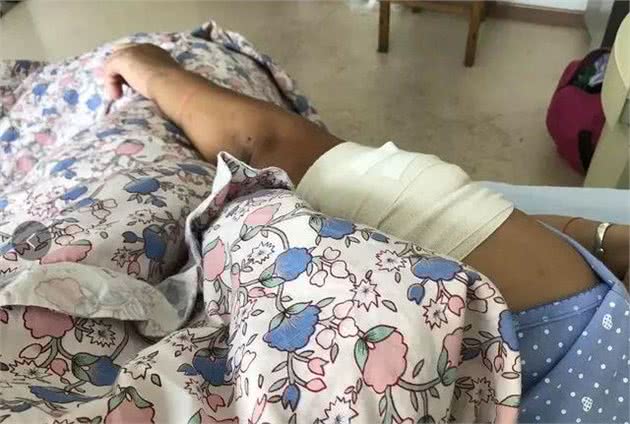 女子被养了5年的狗咬得血肉恍惚已经不是第一次
