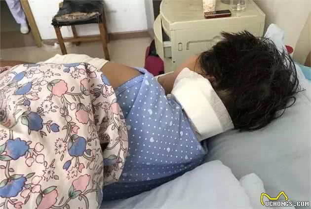 女子被养了5年的狗咬得血肉恍惚已经不是第一次