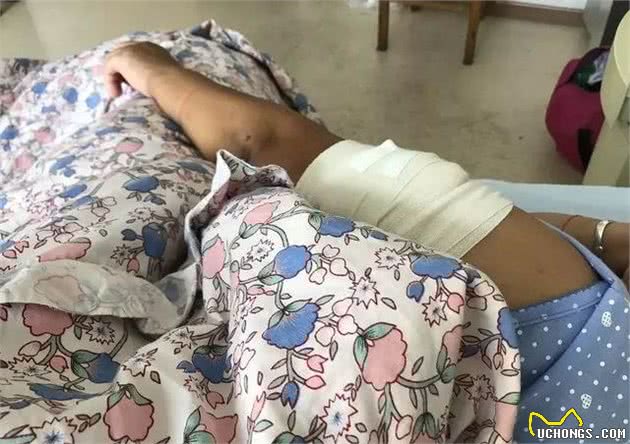 女子被养了5年的狗咬得血肉恍惚已经不是第一次
