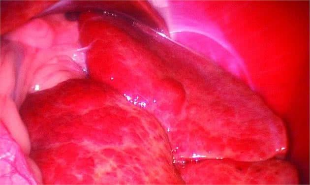 狗狗肝硬化的病发原因、诊断以及治疗措施分析！