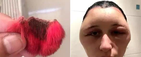 主人为迎新春，特意给狗染了一对红耳朵，没想到却把狗送上手术台