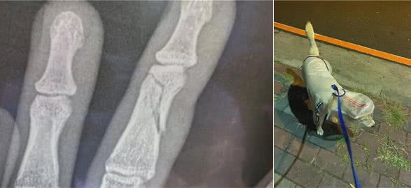 狗子一个爆冲把主人手指拉断…铲屎官：“它太胖了！”