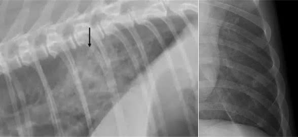 犬猫X光片下常见的四种肺型