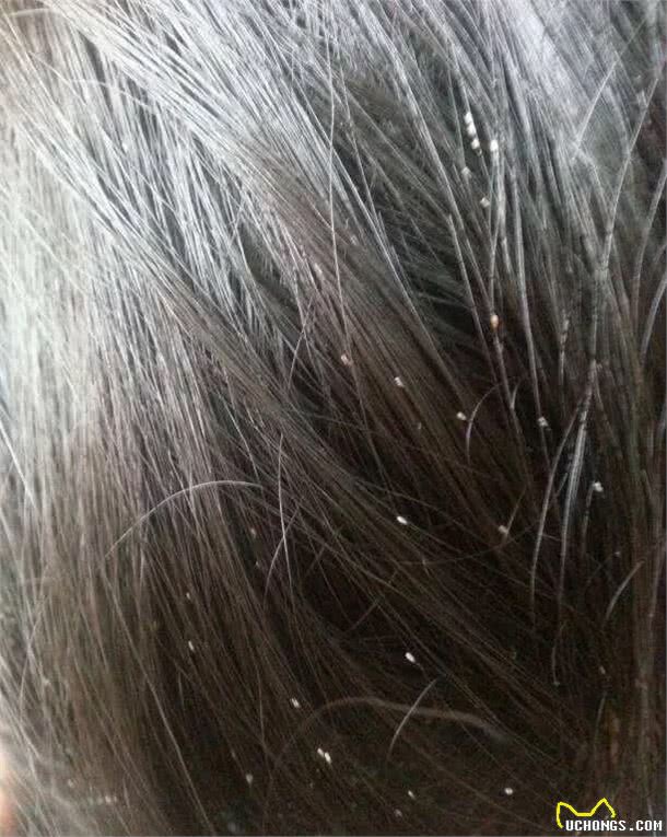 宠物毛发里长的一种小动物非常讨厌，人被叮咬后奇痒无比