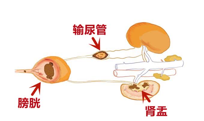 狗狗尿结石如何预防?这3点一定要做到!