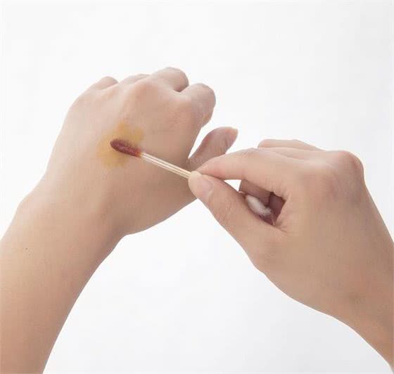 被狗狗抓伤需要打疫苗吗?
