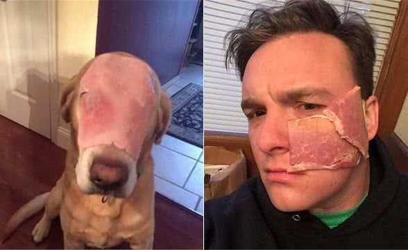 狗狗脸部大面积烧伤让人心疼，仔细再看一次才发现眼泪白流了