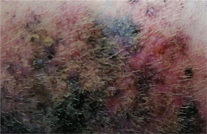 狗的蠕形螨感染